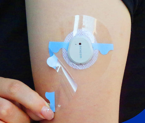 Overt Insulin Pumps, 0.8-Inch Hole, Waterproof, Breathable & Clear Patches [ 5 Pack ]