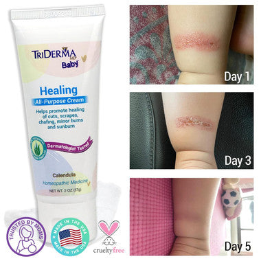 TriDerma Baby All Purpose Healing Cream – 2 oz