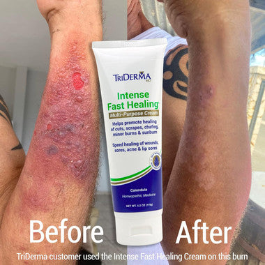 Triderma Intense Fast Healing Multi-Purpose Cream tube 4.2 oz