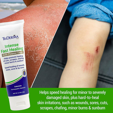 Triderma Intense Fast Healing Multi-Purpose Cream tube 4.2 oz