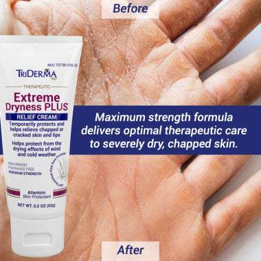 Triderma Extreme Dryness PLUS Relief Cream tube 2.2 oz