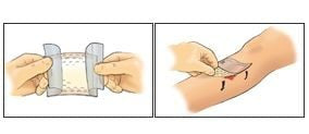 MEDI USA Eclypse Adherent Super Absorbent Dressing, 6" x 6" CR3863