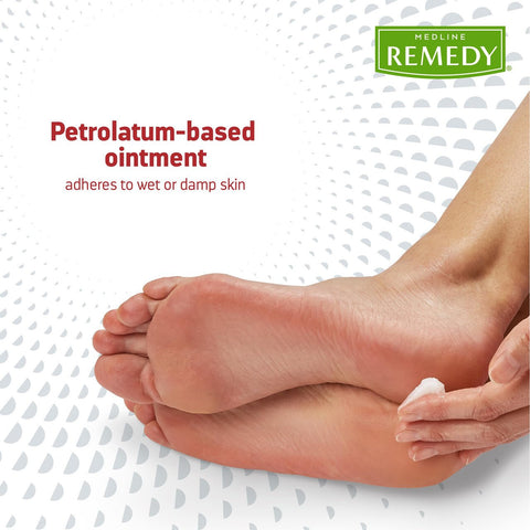 Medline Remedy Clinical Antifungal Ointment  2.5 Ounce